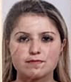 Ölü bulunan Gözde'nin vücudundaki morluklar, 3-4 günlükmüş