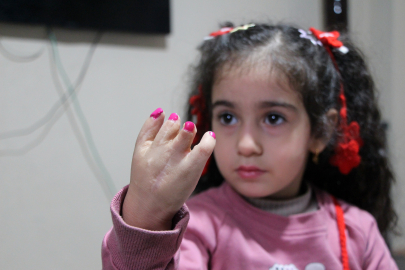 10 ameliyat geçiren yapışık parmak Elif Lina’nın ailesinden çağrı