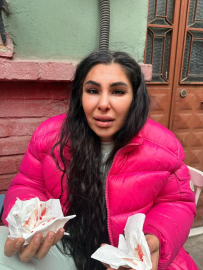 İstanbul - İlişkisini bitirmek istedi darbedilip burnu kırıldı: Yaşamak istiyorum