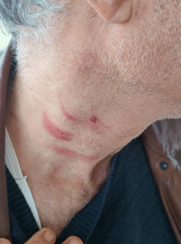 Aile hekimini darbeden müezzin, savcılığın itirazıyla yeniden gözaltına alınıp tutuklandı