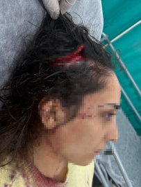 Bakkala giderken sokak köpeklerinin saldırısında yaralandı