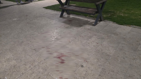 Bursa'da parkta bıçaklı kavga: 1 yaralı