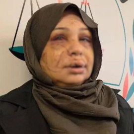 Eşini yaralayan polis memurunun dosyası, ağır cezaya gönderildi