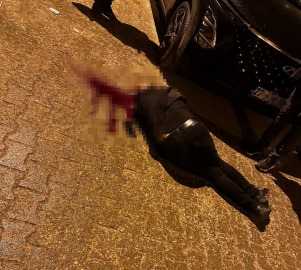 Sokakta yürürken tabanca ile başından vuruldu