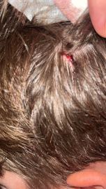 Kucağında bebeği ile darbedilen babanın oğlu, sokakta başına atılan taşla yaralandı