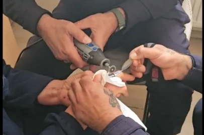 Parmağına sıkışan yüzüğü itfaiye çıkardı