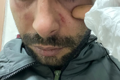 Hastaya yumruk attığı iddiasıyla doktora dava