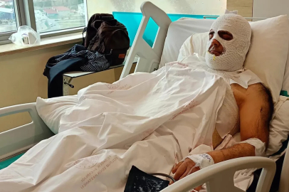 Yüksek gerilim akımına kapılan işçi 42 gündür hastanede